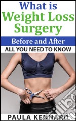 What is weight loss surgery: all you need to know before and after. E-book. Formato EPUB ebook