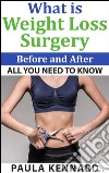 What is weight loss surgery: all you need to know before and after. E-book. Formato Mobipocket ebook