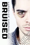 Bruised. E-book. Formato EPUB ebook di Federica Caracciolo