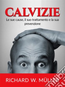 Calvizie (Tradotto)Le sue cause, il suo trattamento e la sua prevenzione. E-book. Formato EPUB ebook di Richard W. Muller