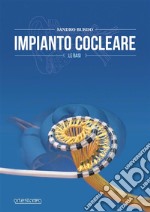 Impianto Cocleare- Le basi. E-book. Formato EPUB ebook