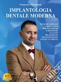Implantologia Dentale ModernaTecniche Moderne E Mininvasive Per Migliorare Il Benessere E La Vita Del Paziente, Tra Innovazione, Estetica E Fiducia. E-book. Formato EPUB ebook