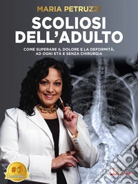 Scoliosi Dell'AdultoCome Superare Il Dolore E La Deformità, Ad Ogni Età E Senza Chirurgia. E-book. Formato EPUB ebook