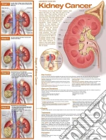 Acc - Understanding Kidney Cancer 2E Lamin giochi