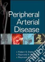 Peripheral Arterial Disease libro