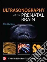 Ultrasonography of the prenatal & neonatal brain