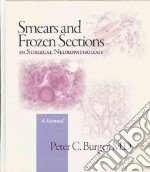 Smears and frozen sections in surgical neuropathology. A manual