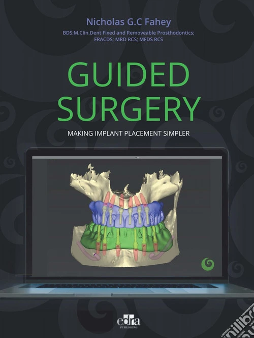 Guided surgery. Making implant placement simpler