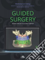 Guided surgery. Making implant placement simpler libro