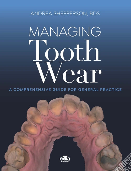 Managing tooth Wear. A comprehensive guide for general practice
