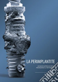 La perimplantite. Un nuovo approccio alla prevenzione e al suo trattamento libro