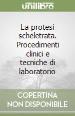 La protesi scheletrata. Procedimenti clinici e tecniche di laboratorio