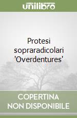 Protesi sopraradicolari 'Overdentures'