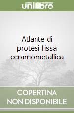 Atlante di protesi fissa ceramometallica