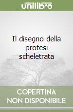 Il disegno della protesi scheletrata