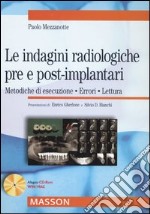 Le indagini radiologiche pre e post-implantari. Metodiche di esecuzione. Errori. Lettura