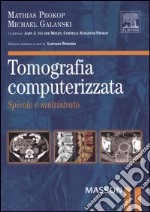 Tomografia computerizzata. Spirale e multistrato