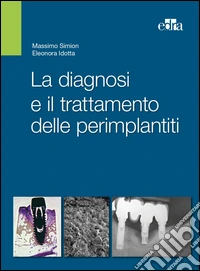 La diagnosi e il trattamento delle perimplantiti libro