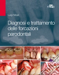 Diagnosi e trattamento delle forcazioni parodontali libro