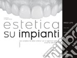 Estetica su impianti. Risolvere casi complessi nei settori anteriori con un approccio globale al sorriso del paziente