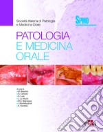 Patologia e medicina Orale libro