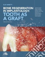 Bone regeneration in implantology: tooth as a graft libro