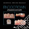 Endocrown. Una nuova via per la ricostruzione dei denti trattati endodonticamente libro