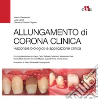 Allungamento di corona clinica. Razionale biologico e applicazione clinica libro