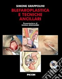 Blefaroplastica e tecniche ancillari. Con DVD