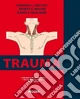Trauma