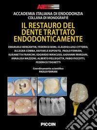Il restauro del dente trattato endodonticamente libro
