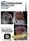 Malformazioni fetali 8.0: dalla diagnosi alla terapia libro di Pilu Gianluigi Volpe Paolo