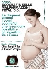 Corso ecografia delle malformazioni fetali 5.0. Le diagnosi difficili: i segni ecografici che le rendono possibili e gli algoritmi da seguire libro di Pilu Gianluigi Volpe Paolo