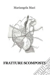 Fratture scomposte