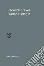 L'uomo elefante