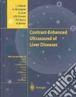 Contrast-enhanced. Ultrasound of liver diseases libro