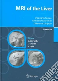 MRI of the Liver. Imaging techniques, contrast enhancement, differential diagnosis libro