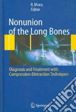 Nununion of the long bones. Diagnosis and treatment with compression-distraction techniques libro