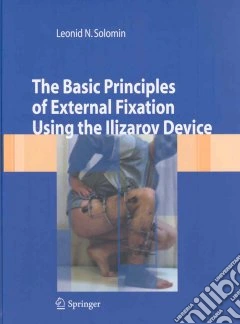 The basic principles of external skeletal fixation using Ilizarov device