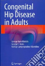 Congenital Hip Disease in Adults libro