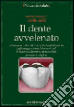 Il dente avvelenato. La sindrome da metalli tossici e il rebus della tossicità degli amalgami dentari: mercury gate? libro