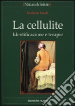 La cellulite. Identificazione e terapie