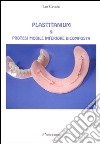 Plastitanium & protesi mobile inferiore bicomposta libro