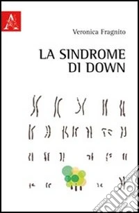 La sindrome di Down
