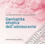 Dermatite atopica dell'adolescente