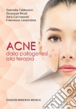 Acne. Dalla patogenesi alla terapia libro