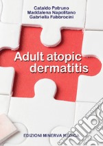 Adult atopic dermatitis libro