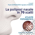 La poliposi nasale in 70 scatti. Atlante fotografico. Ediz. illustrata