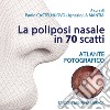 La poliposi nasale in 70 scatti. Atlante fotografico. Ediz. illustrata libro