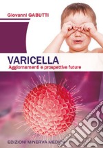 Varicella. Aggiornamenti e prospettive future